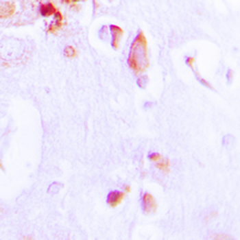 Anti-ARRDC3 Antibody