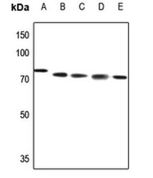 Anti-ABCB10 Antibody