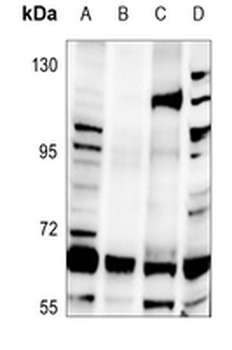 Anti-hnRNP Q Antibody