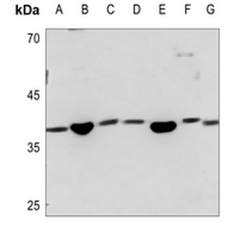 Anti-SAE1 Antibody