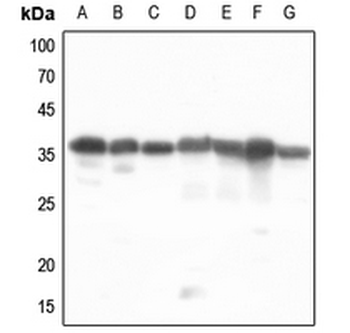 Anti-PDLIM1 Antibody