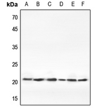 Anti-Claudin 1 Antibody