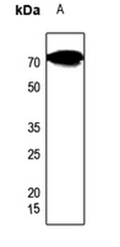 Anti-CES2 Antibody