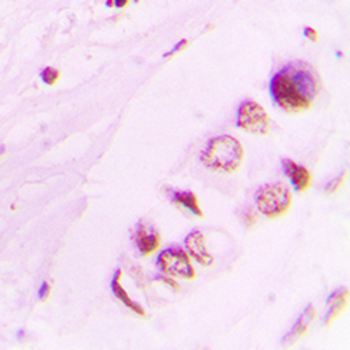 Anti-Histone H3 (AcK9) Antibody