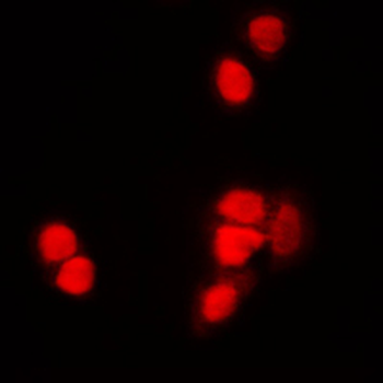 Anti-Histone H3 (AcK9) Antibody