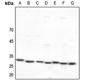 Anti-14-3-3 epsilon Antibody