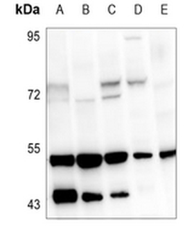 Anti-VDR Antibody