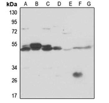 PSMC6 Antibody