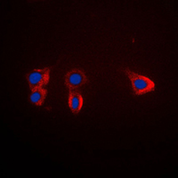 Anti-TRK B Antibody