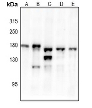 Anti-TRK B (pY516) Antibody
