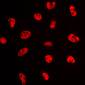 Anti-NFYA Antibody