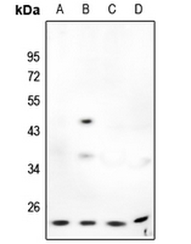Anti-MMP7 Antibody