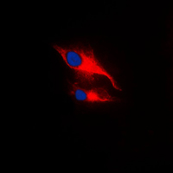 Anti-LCK (pY393) Antibody