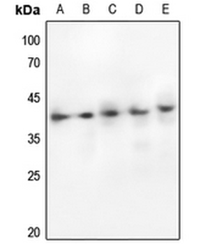 Anti-GSK3 alpha/beta Antibody