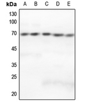 Anti-GRK5 Antibody