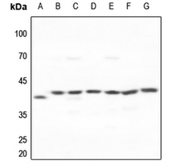 Anti-Galactose Kinase Antibody