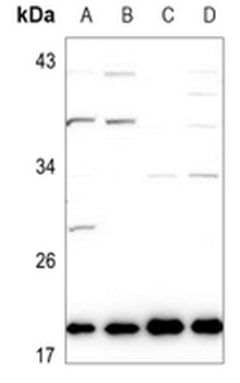 Anti-Ephrin A1 Antibody