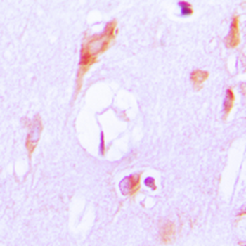 Anti-Cytochrome P450 27A1 Antibody