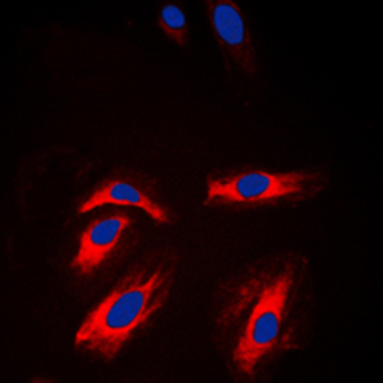 Creatine Kinase M Antibody