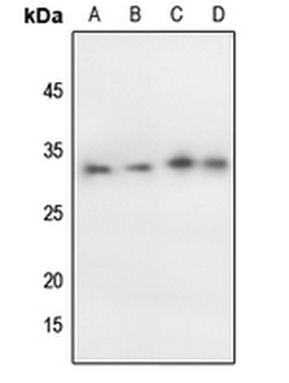 p27 Kip1 (pT198) Antibody