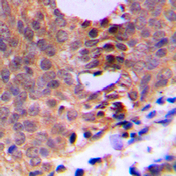 Anti-CDC2 (pT161) Antibody