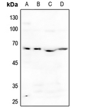 Anti-ACVR1B Antibody