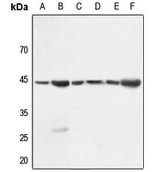 Anti-Gamma-actin-1 Antibody