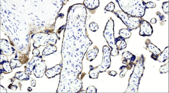 Recombinant PD-L1 antibody [AK94]