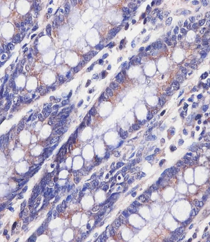 PABPC3 Antibody (N-Term)