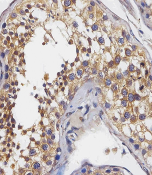 PABPC3 Antibody (N-Term)