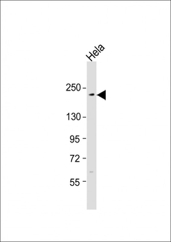 XRN1 Antibody (C-term)