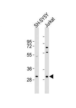TRMT61A Antibody (N-term)