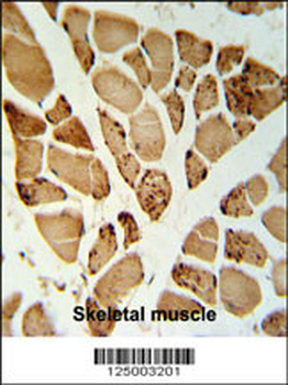 5NT1A Antibody (N-term)