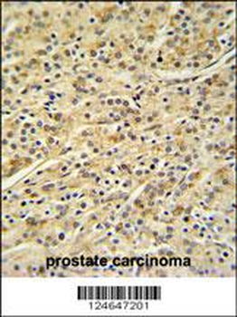 HOXA3 Antibody (C-term)