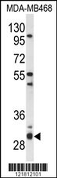 PSMG2 Antibody (C-term)