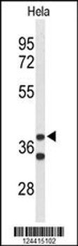 CYTH3 Antibody (C-term)