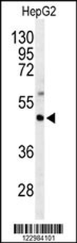 GNAZ Antibody (N-term)