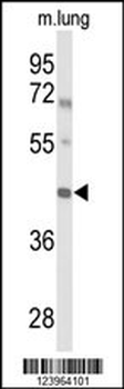 IRX2 Antibody (Center)