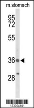 BRS3 Antibody (Center)