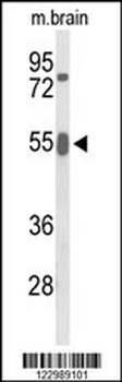 GRB7 Antibody (Center)