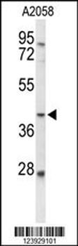FUT3 Antibody (C-term)