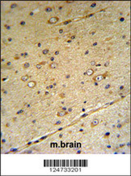 S39A3 Antibody (Center)