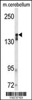 VGFR2 Antibody