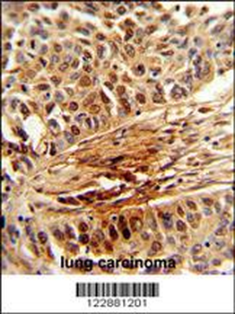 PIN1 Antibody (Center)