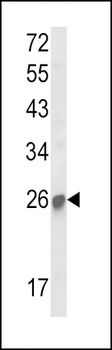 SOCS1 antibody