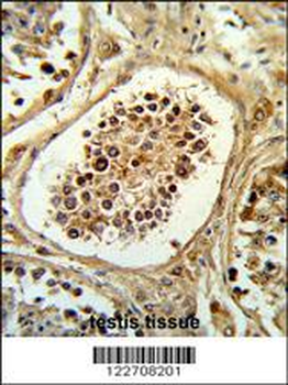 EGLN2 Antibody (Center)