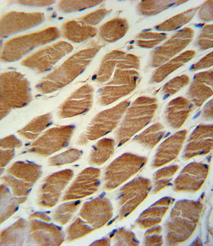 ACADL Antibody (Center)