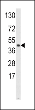 SKP2 Antibody (Center)