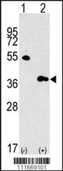GBL Antibody (Center)