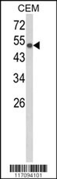 CYP8A1 Antibody (C-term)